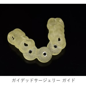 インプラントオペ用ガイド｜【症例】サージカルガイドを用いた前歯部インプラント（ガイデッドサージェリー） ｜馬車道の歯医者 馬車道アイランドタワー歯科